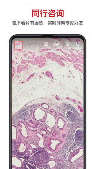 爱病理app手机赚钱软件截图5